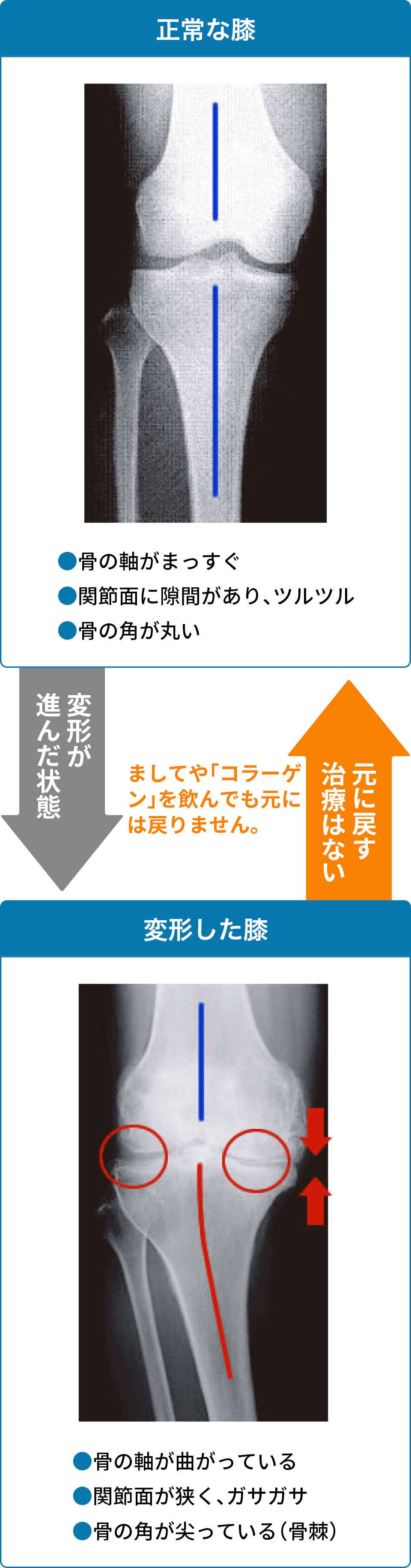 ユニタ クリニック ひざの痛み